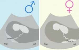 Descubre el Sexo de tu Bebé con Estas Apps